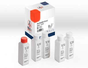 Bilirubin Direct